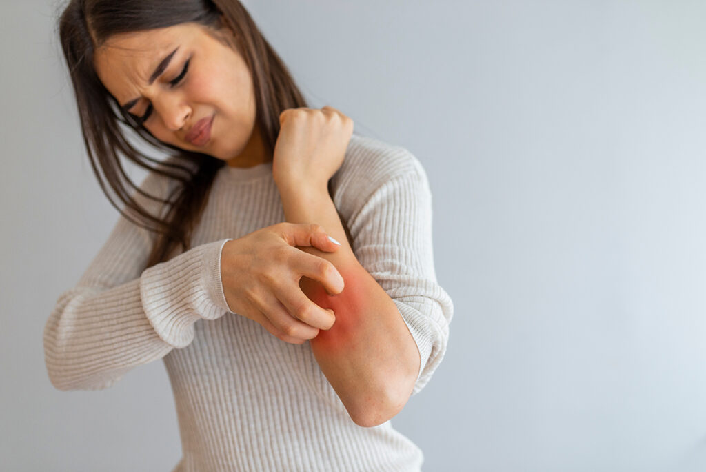 A woman suffering from an autoimmune disease