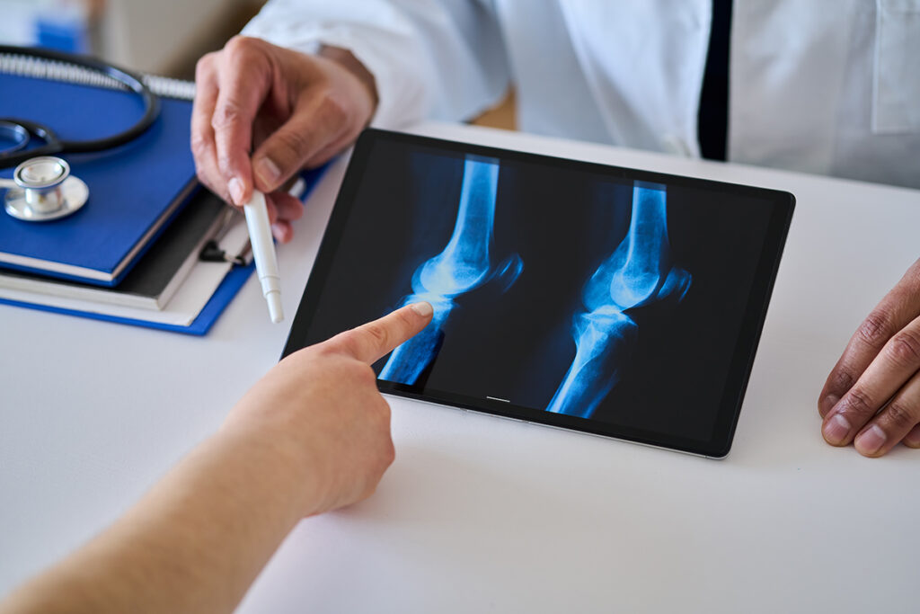 A patient consulting a rheumatologist regarding joint inflammation.
