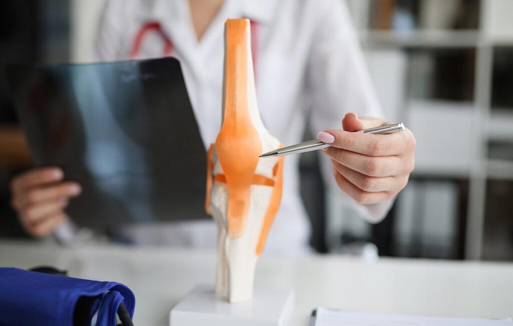 A doctor pointing to a model of a knee joint during a consultation session.