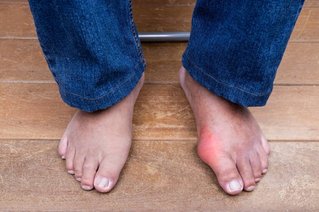 A man with swollen feet