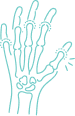 <p>Rheumatoid Arthritis</p>
