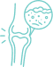<p>Psoriatic Arthritis</p>
