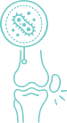 <p>Post-Infective Arthritis</p>
