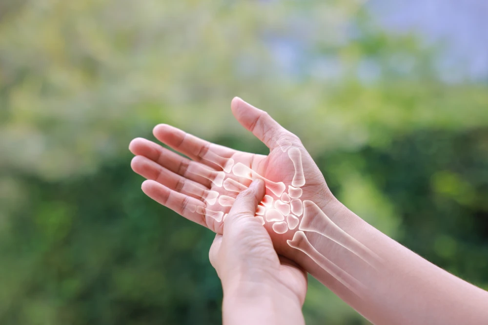 What Is Arthritis?