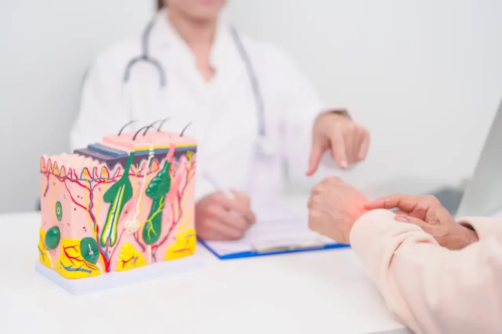 Rheumatologist assessing patient’s lupus symptoms on hand