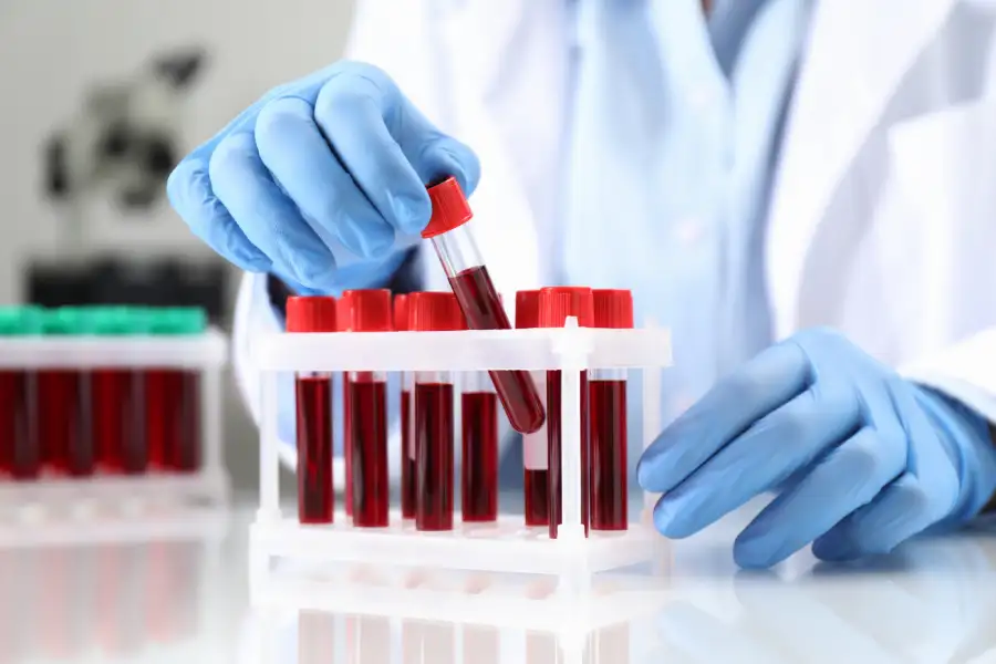 What Is Autoimmune Testing?