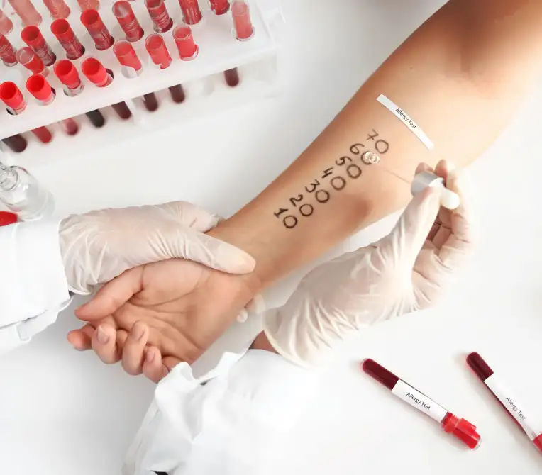 What is an Allergy Provocation/Challenge Test?