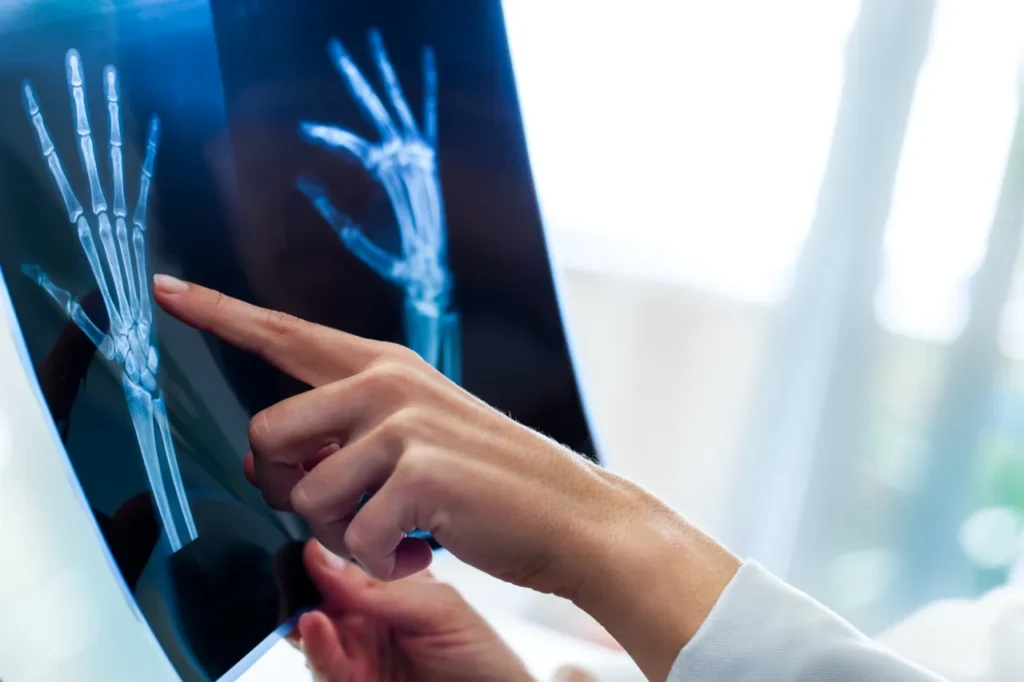 Doctor looking at a scan of a patient